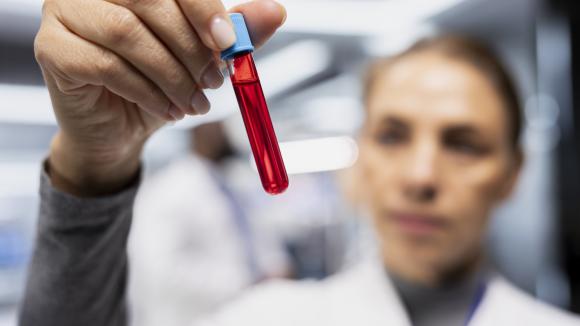 Demencja rośnie w Europie. Polski test z kropli krwi ma pomóc wykrywać ryzyko choroby