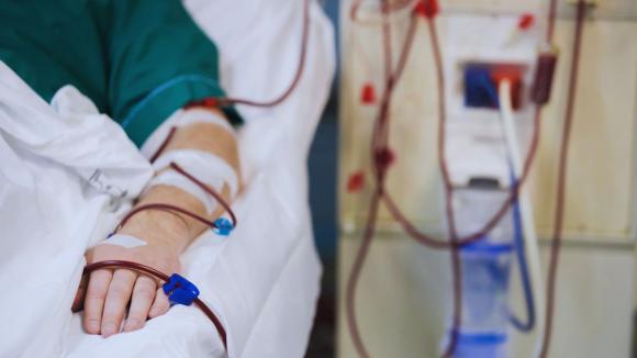 Pacjenci apelują o zmiany w leczeniu chorób nerek. Chcą większego dostępu do dializ otrzewnowych