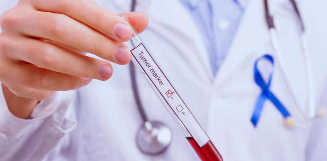 Personalizacja leczenia onkologicznego wymaga nie tylko nowych terapii, ale przede wszystkim właściwie zaplanowanej diagnostyki
