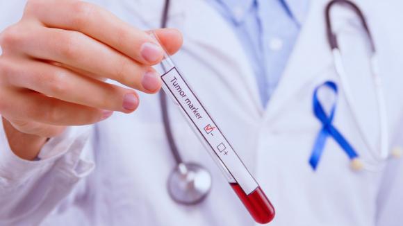 Personalizacja leczenia onkologicznego wymaga nie tylko nowych terapii, ale przede wszystkim właściwie zaplanowanej diagnostyki