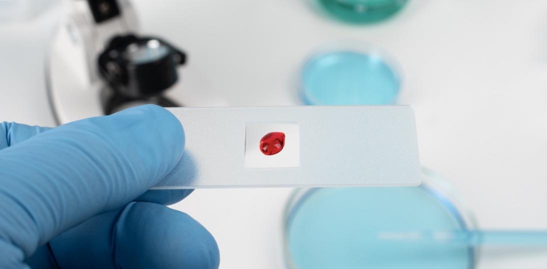 Standardy leczenia nowotworów krwi dynamicznie się zmieniają. W programach lekowych dostępne są nowe metody terapeutyczne