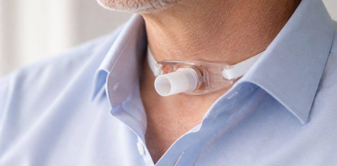 Po laryngektomii pacjent nie może zostać sam. Kompleksowa opieka wciąż jest w Polsce bardziej postulatem niż standardem