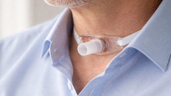 Po laryngektomii pacjent nie może zostać sam. Kompleksowa opieka wciąż jest w Polsce bardziej postulatem niż standardem