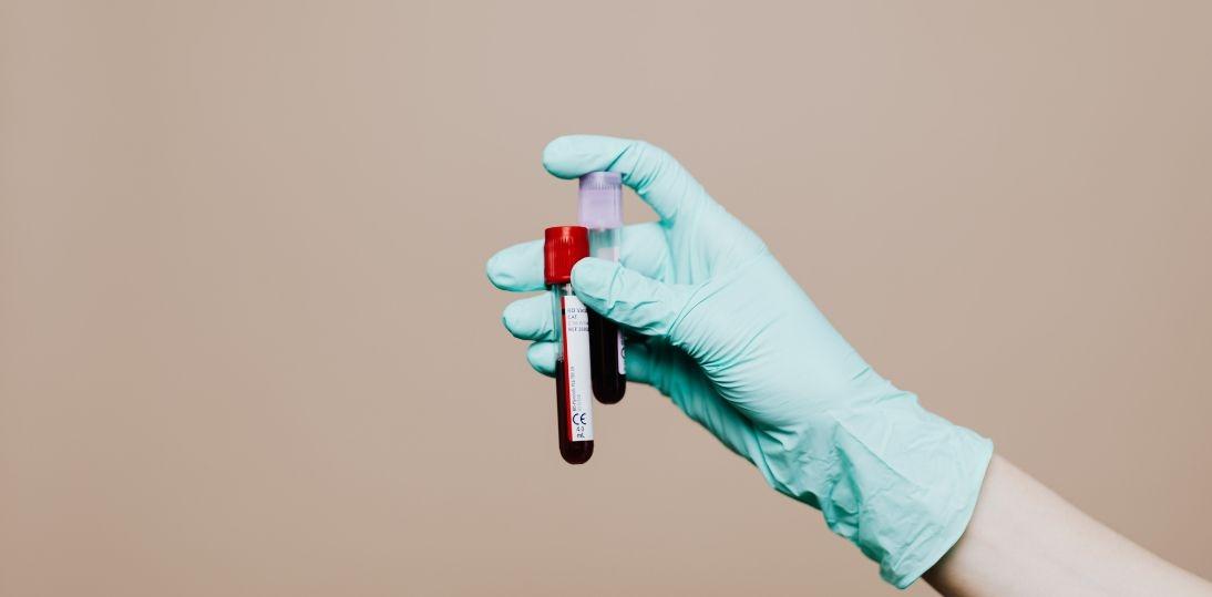 Każda minuta ma znaczenie. Dr Katarzyna Majzner o badaniach, które mogą zmienić los pacjentów z nowotworami krwi