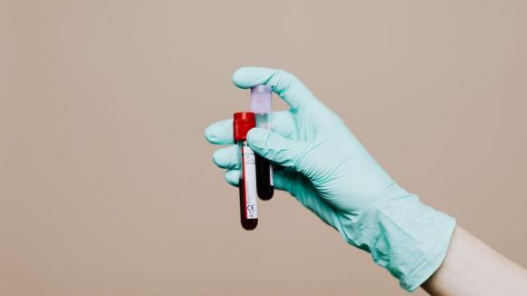 Każda minuta ma znaczenie. Dr Katarzyna Majzner o badaniach, które mogą zmienić los pacjentów z nowotworami krwi