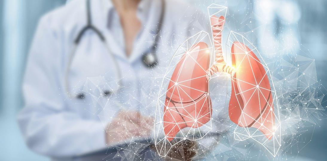 EMA rekomenduje tarlatamab w nawrotowym drobnokomórkowym raku płuca. Nowa opcja po niepowodzeniu chemioterapii platyną