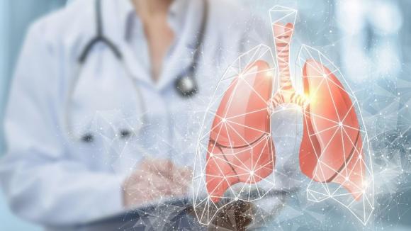 EMA rekomenduje tarlatamab w nawrotowym drobnokomórkowym raku płuca. Nowa opcja po niepowodzeniu chemioterapii platyną