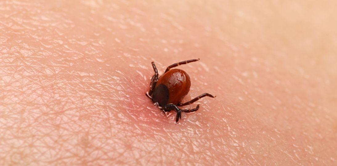 Wzrost liczby zakażeń wirusem KZM w Polsce. Coraz więcej osób deklaruje kontakt z kleszczami w ostatnim roku