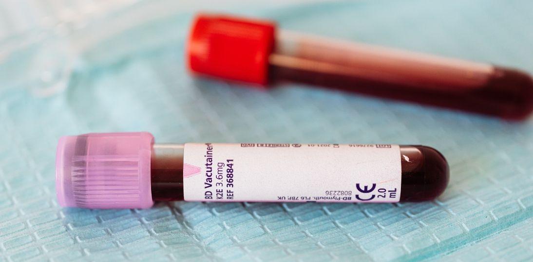 Hemofilia w Polsce. Ile naprawdę kosztuje życie z chorobą mimo refundacji leczenia?