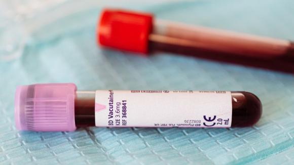 Hemofilia w Polsce. Ile naprawdę kosztuje życie z chorobą mimo refundacji leczenia?