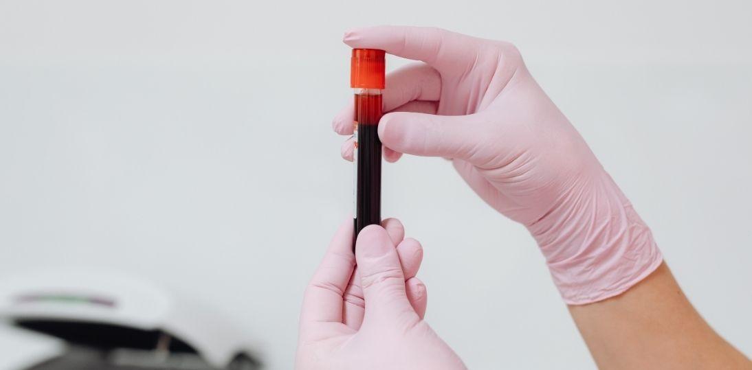 Niektóre decyzje jeszcze w tym roku? TOP 10 HEMATO pokazuje, czego najbardziej potrzebuje polska hematologia