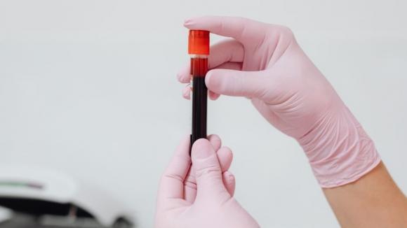 Niektóre decyzje jeszcze w tym roku? TOP 10 HEMATO pokazuje, czego najbardziej potrzebuje polska hematologia