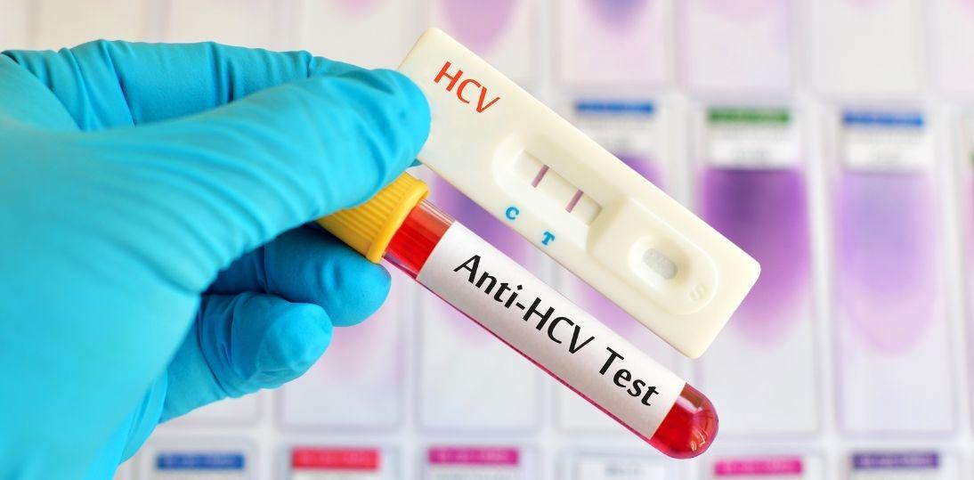 Nawet 80 proc. zakażonych wirusem HCV nie ma objawów. Rządowy program Moje Zdrowie zwiększył wykrywalność chorób wątroby