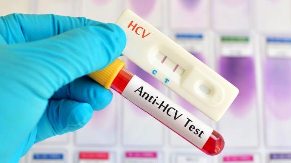 Nawet 80 proc. zakażonych wirusem HCV nie ma objawów. Rządowy program Moje Zdrowie zwiększył wykrywalność chorób wątroby