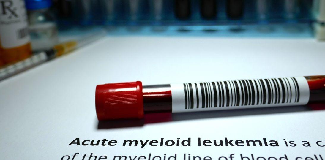 Ostra białaczka szpikowa może się skończyć zgonem nawet w kilka miesięcy. Nieswoiste objawy łatwo pomylić ze zwykłym zmęczeniem