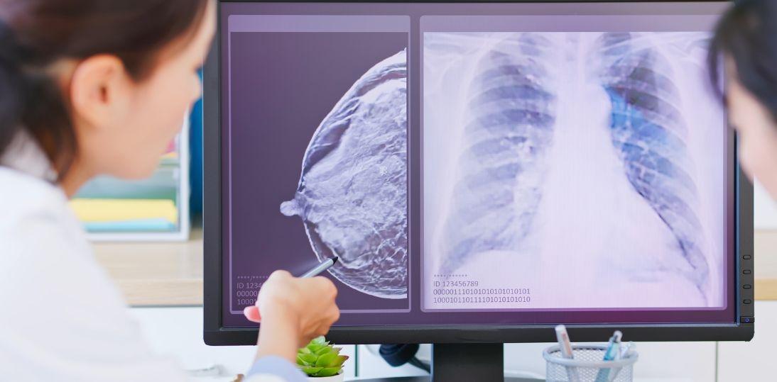 Ekspert UMW współtworzył polską edycję najnowszych wytycznych NCCN dotyczących raka piersi