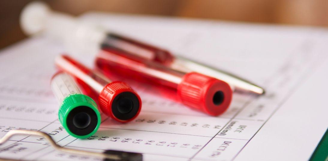 Szpiczak coraz częściej staje się chorobą przewlekłą. Kluczowe są czujność i nowoczesna diagnostyka