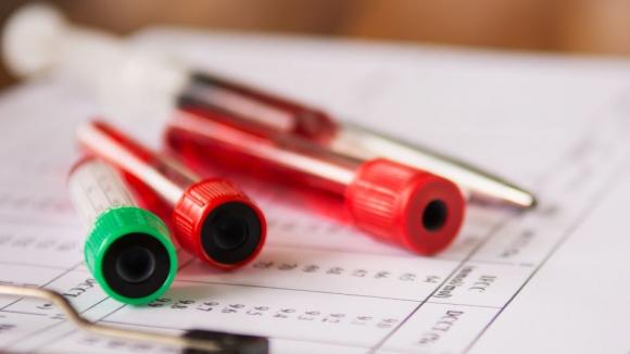 Szpiczak coraz częściej staje się chorobą przewlekłą. Kluczowe są czujność i nowoczesna diagnostyka