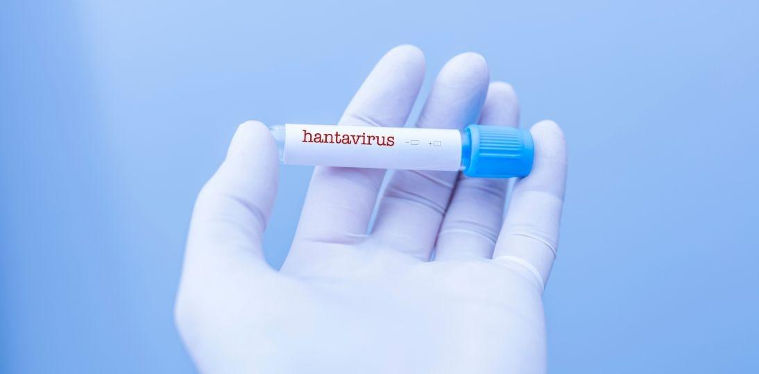 Hantawirus na statku Hondius uruchomił falę dezinformacji. Eksperci: większym problemem była infodemia niż sam wirus