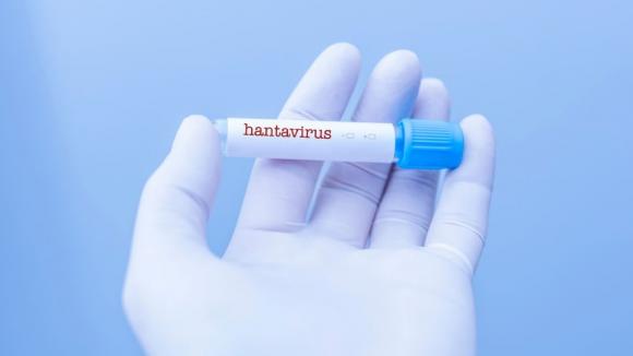 Hantawirus na statku Hondius uruchomił falę dezinformacji. Eksperci: większym problemem była infodemia niż sam wirus