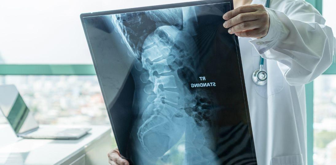 SMA staje się chorobą przewlekłą. Eksperci stawiają na personalizację leczenia i opiekę przez całe życie