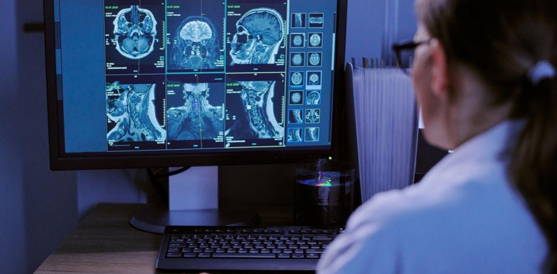 Choroby mózgu coraz większym wyzwaniem dla Europy. Eksperci apelują o stworzenie sieci neurologicznej i Europejskiego Planu Zdrowia Mózgu