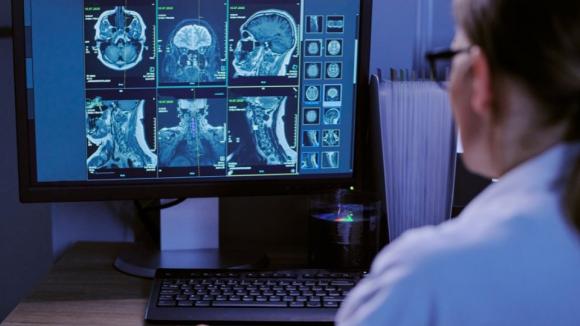 Badania genetyczne mogą otworzyć drogę do leczenia ALS. Problemem pozostaje czas diagnozy