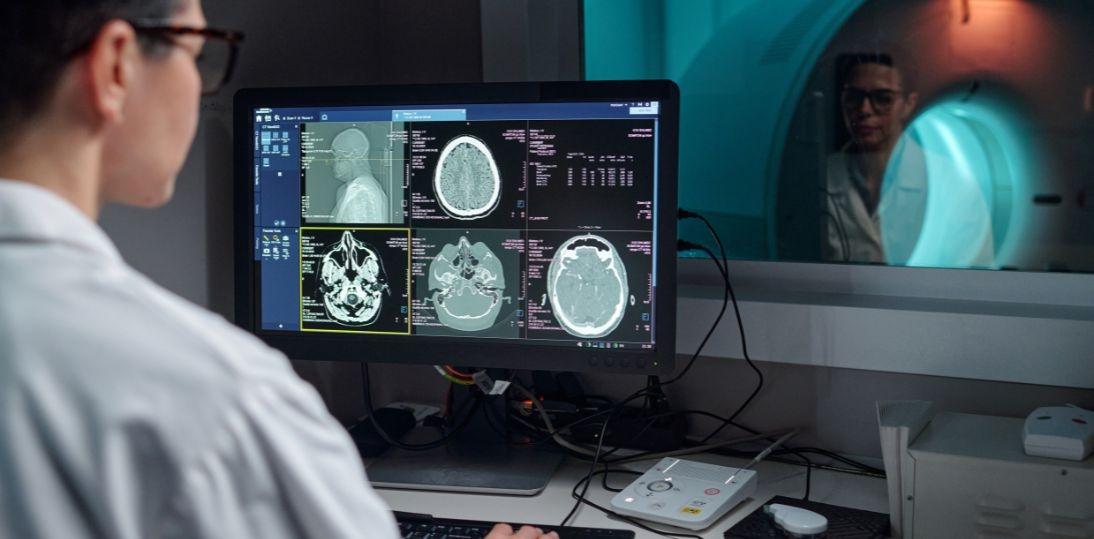 Polscy naukowcy opracowali system AI do oceny ryzyka pęknięcia tętniaków mózzgu. Publikacja w prestiżowym „Radiology: Artificial Intelligence”