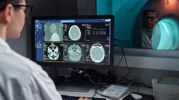 Polscy naukowcy opracowali system AI do oceny ryzyka pęknięcia tętniaków mózzgu. Publikacja w prestiżowym „Radiology: Artificial Intelligence”