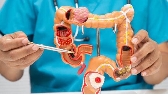 GIST: nowe terapie i badania kliniczne dają nadzieję pacjentom z nowotworami podścieliskowymi przewodu pokarmowego