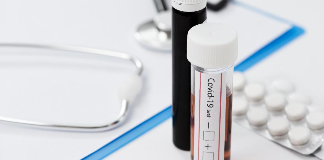 MZ: Zasady zlecania testów na koronawirusa dla lekarzy rodzinnych