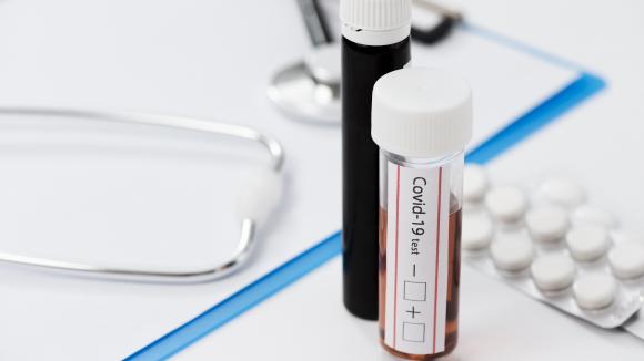 MZ: Zasady zlecania testów na koronawirusa dla lekarzy rodzinnych