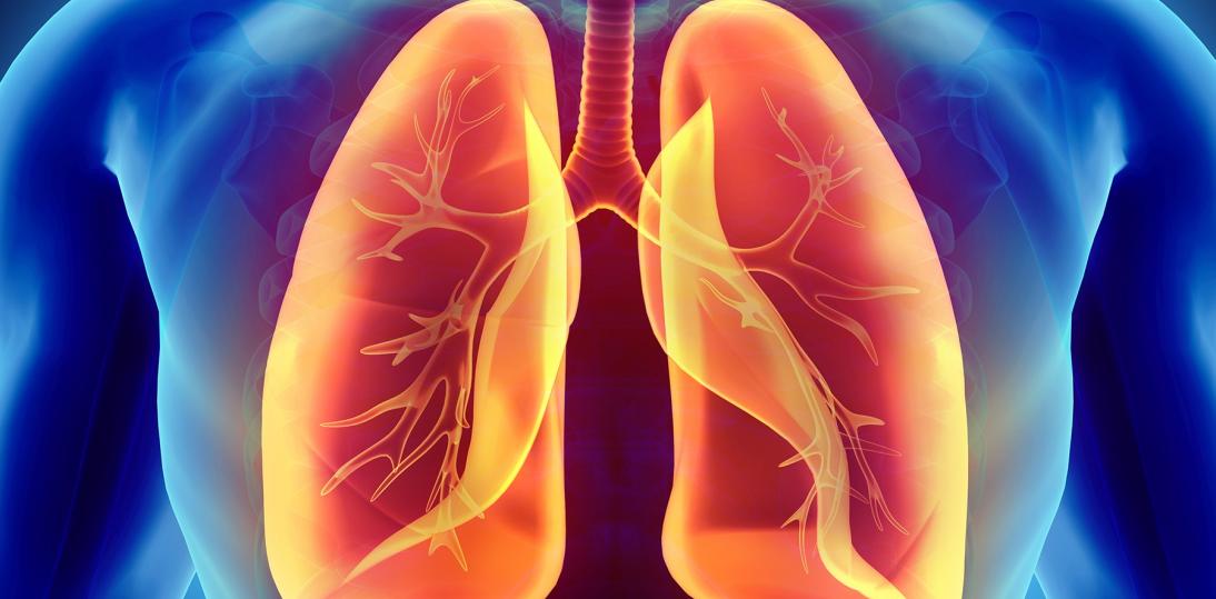 Rak płuca - wyścig z czasem, który można wygrać