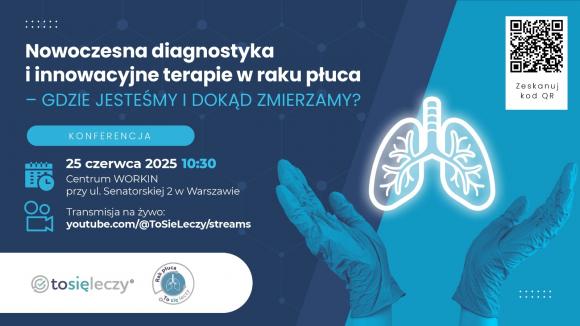 Konferencja prasowa „Nowoczesna diagnostyka i innowacyjne terapie w raku płuca – gdzie jesteśmy i dokąd zmierzamy?”
