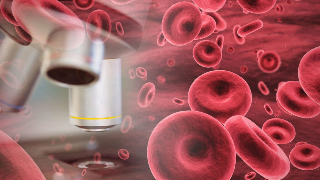 Pacjenci hematologiczni żyją coraz dłużej – Wrzesień Światowym Miesiącem Świadomości Nowotworów Krwi