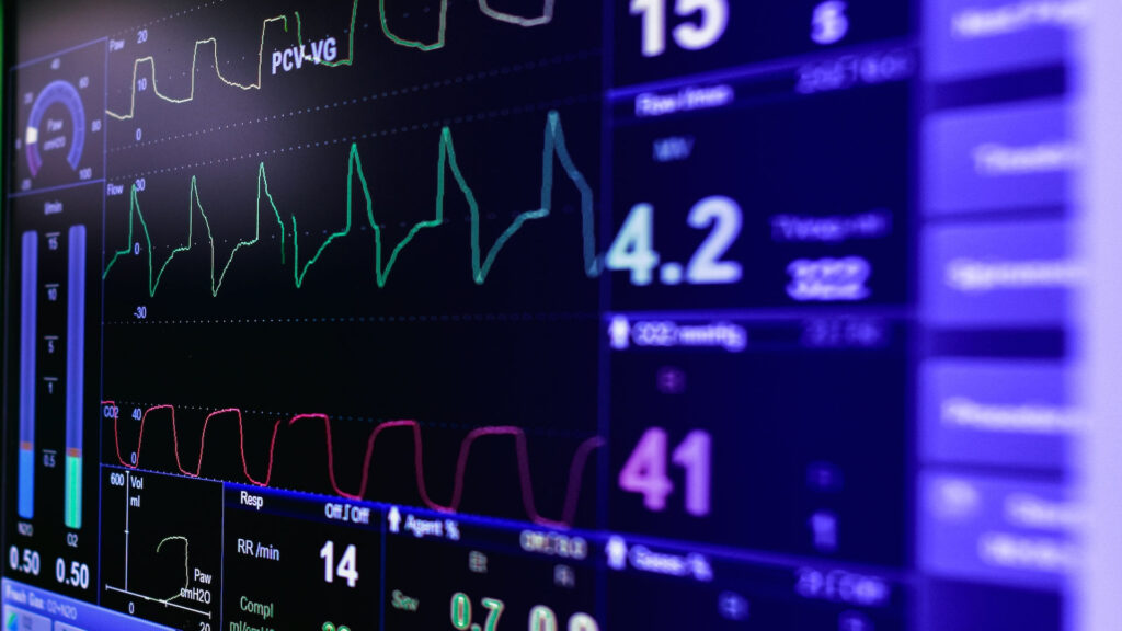 Nawet 280 tys. Polaków może mieć nierozpoznane nieme klinicznie, napadowe migotanie przedsionków