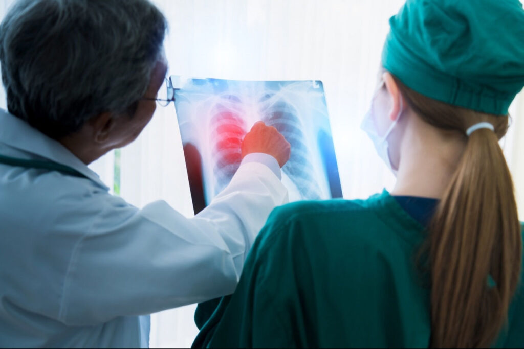 Zaawansowane prace nad terapią komórkową raka płuca na Uniwersytecie Gdańskim. Odkrycia projektu SWIFT wesprą też diagnostykę tej choroby