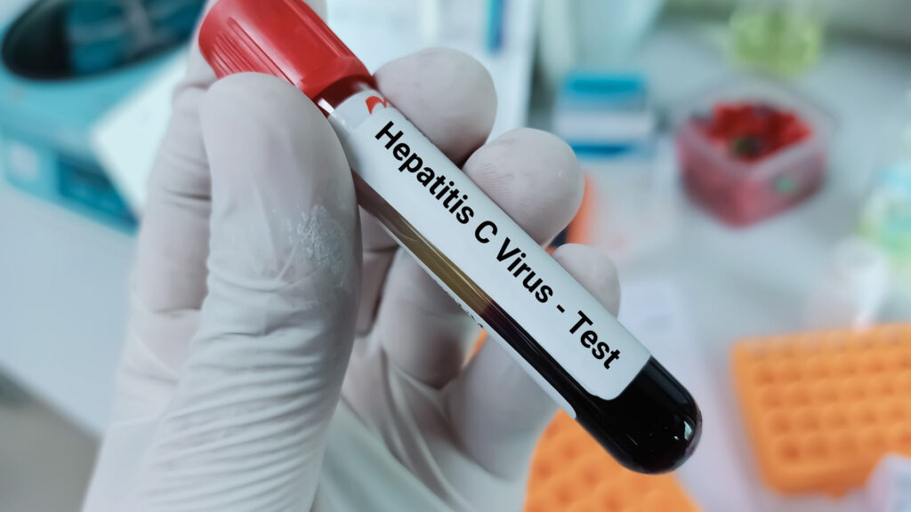 Zadbaj o zdrowie z końcem roku! Zapytaj w POZ o badania anty-HCV