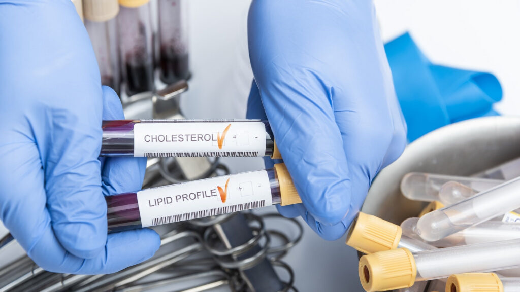 Pacjenci apelują: wprowadźmy badania przesiewowe w kierunku hipercholesterolemii rodzinnej. Wcześnie zdiagnozowani chorzy mogą uniknąć przedwczesnej śmierci