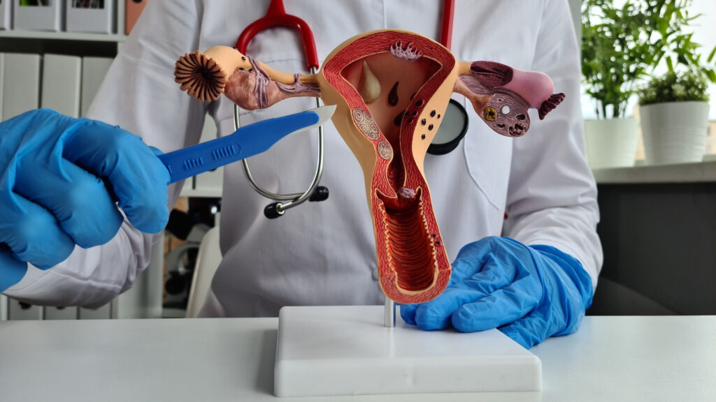 Szpital Medicover: Endometrioza odsłoni swą twarz! Wykonaj test na endometriozę