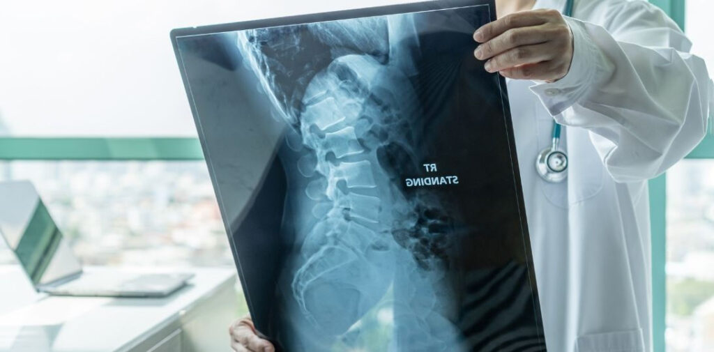 SMA staje się chorobą przewlekłą. Eksperci stawiają na personalizację leczenia i opiekę przez całe życie