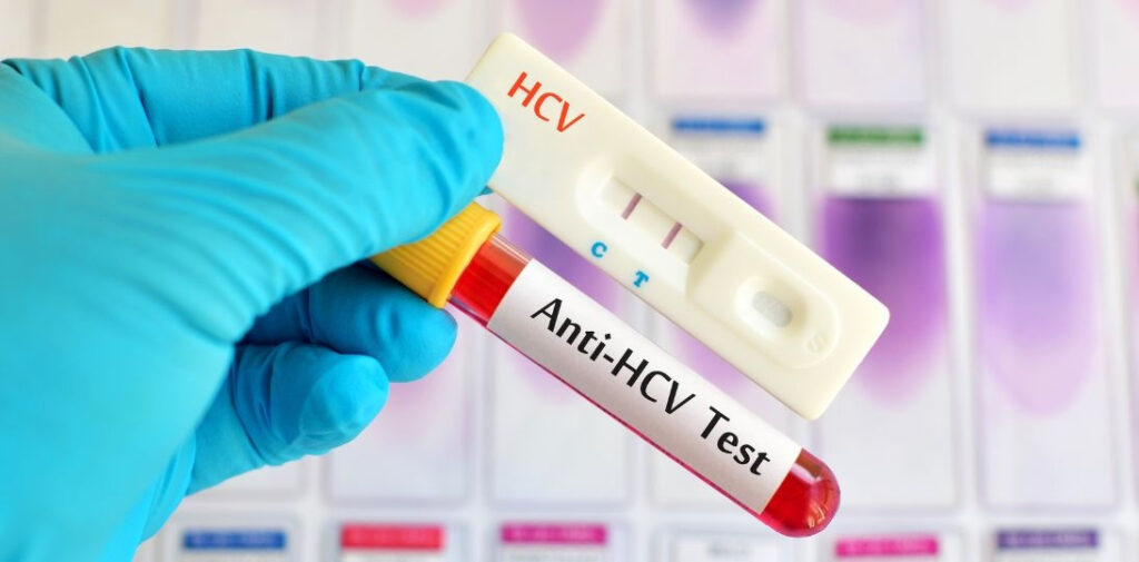 Nawet 80 proc. zakażonych wirusem HCV nie ma objawów. Rządowy program Moje Zdrowie zwiększył wykrywalność chorób wątroby