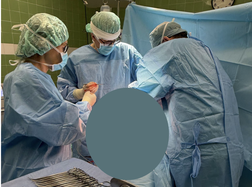 20-kilogramowy guz usunięty w Narodowym Instytucie Onkologii. Eksperci przypominają, dlaczego mięsaki powinny być leczone w ośrodkach referencyjnych
