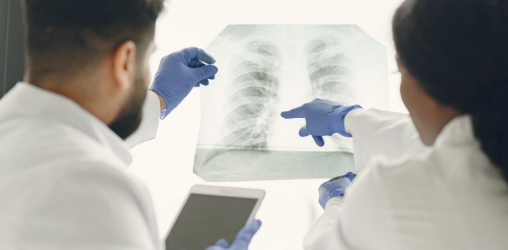 FDA zatwierdziła nową terapię dla chorych na ROS1-dodatniego raka płuca po wcześniejszym leczeniu