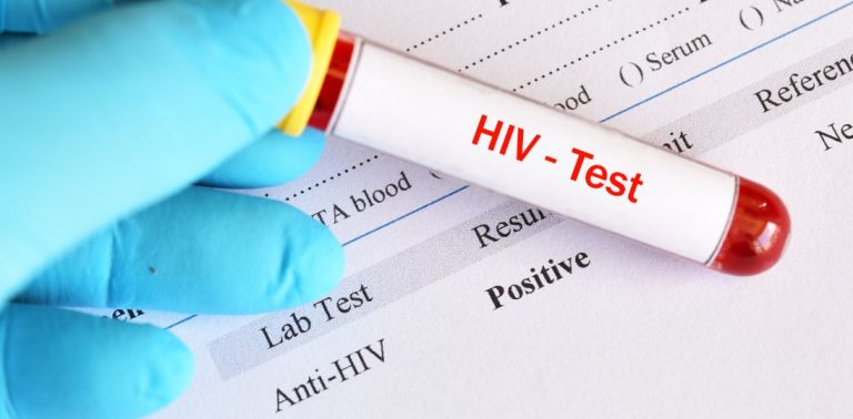 Życie z HIV może być normalne. Kampania „Pozytywnie też znaczy dobrze” przełamuje stereotypy i promuje testowanie