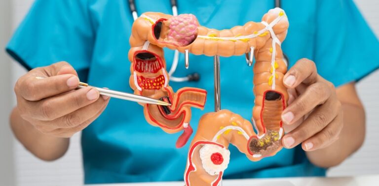 GIST: nowe terapie i badania kliniczne dają nadzieję pacjentom z nowotworami podścieliskowymi przewodu pokarmowego