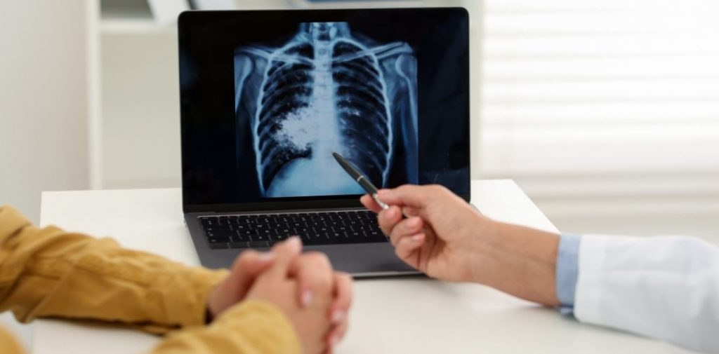 Diagnostyka raka płuca w jeden dzień zamiast kilku dni w szpitalu. Otwocki ośrodek po modernizacji za 104 mln zł