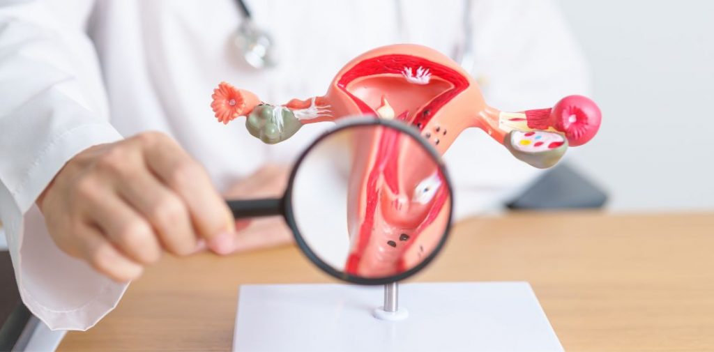 Nowy etap profilaktyki raka szyjki macicy. Od 1 sierpnia test HPV HR całkowicie zastępuje cytologię w programie NFZ