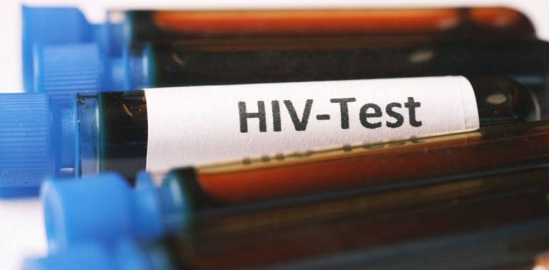 HIV można skutecznie leczyć, ale stygmatyzacja nadal utrudnia diagnostykę. Eksperci apelują o edukację i testowanie