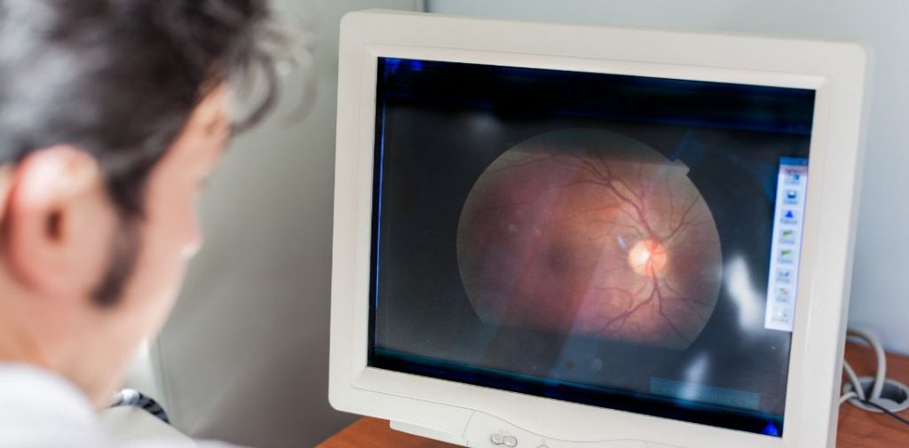 Sztuczna inteligencja może wspierać lekarzy w diagnostyce rzadkich chorób siatkówki